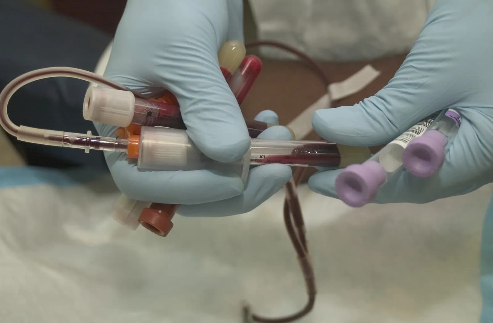 England on Track to Eliminate Hepatitis C, Officials Say
